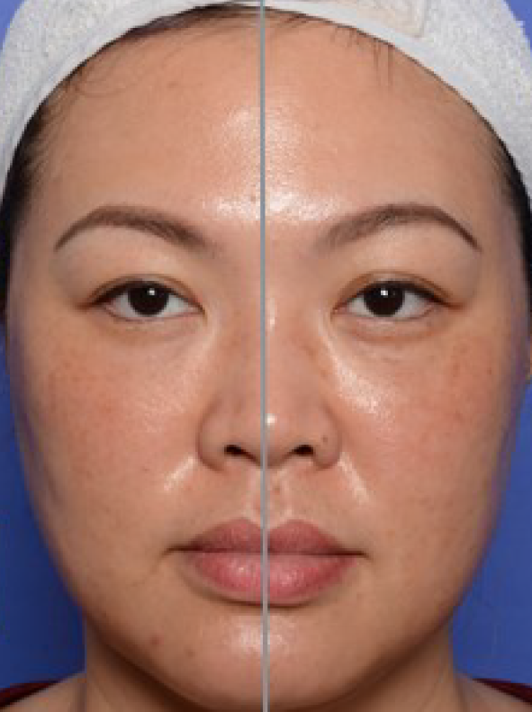 RNC_Pro-Site_After_PDP-05