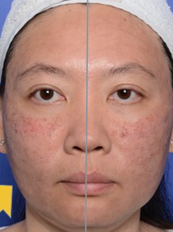 美容液 CALECIM Recovery Night Complex 60g Calecim Recovery Night Complex - LAZ Skincare