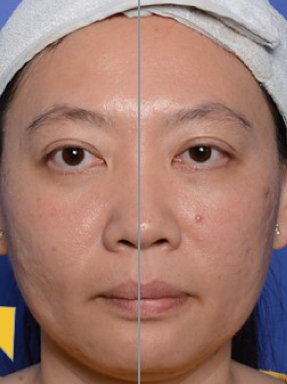 RNC_Pro-Site_After_PDP-07