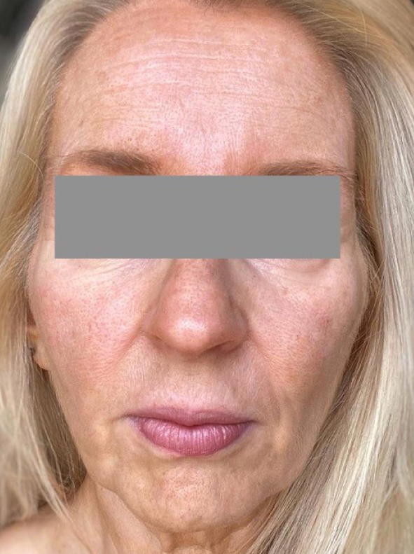 SERUM_Pro-Site_PDP-01