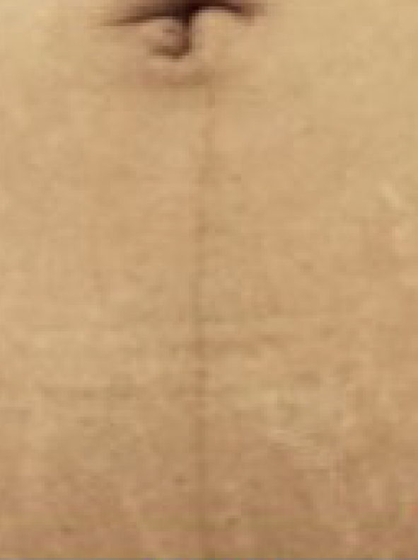 SERUM_Pro-Site_PDP-07