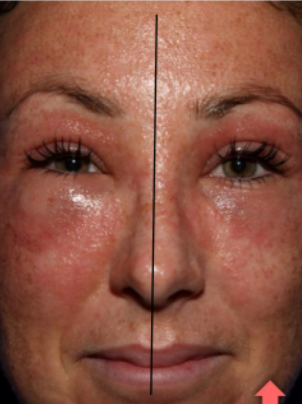 SERUM_Pro-Site_PDP-08