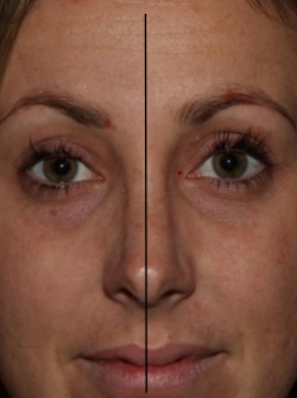 SERUM_Pro-Site_PDP-09