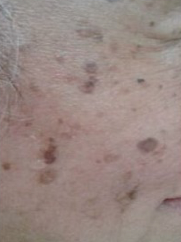 SERUM_Pro-Site_PDP-03