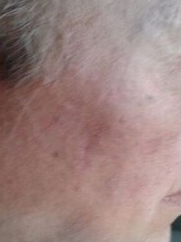 SERUM_Pro-Site_PDP-05