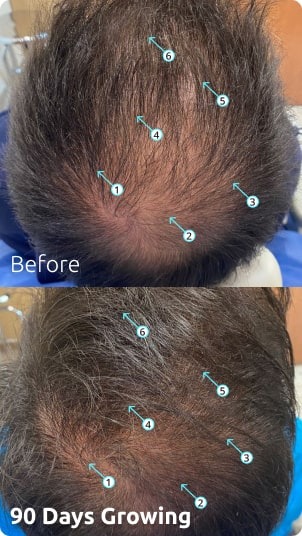 Revita | Extra Strength Hair DENSITY Shampoo