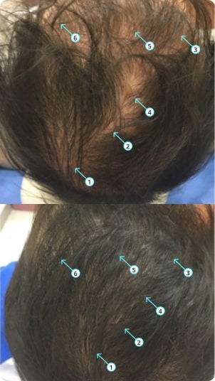 Revita | Extra Strength Hair DENSITY Shampoo