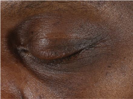 Liver, Wood, Working animal, Wrinkle, Snout, Terrestrial animal, Fur, Hardwood, Fashion accessory, Wood stain