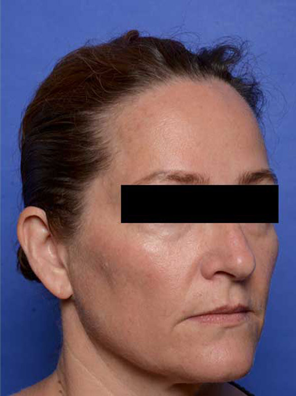 rhc-after-2-new